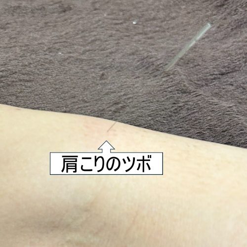 肩まわりのツボの位置を示した写真